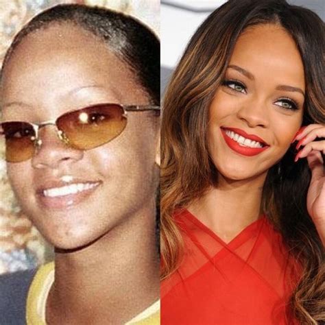 rihanna hearing aid|rihanna before and after.